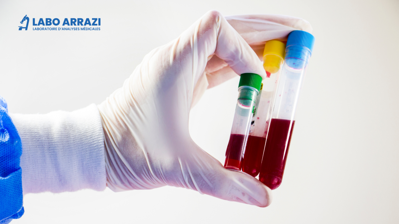 Bilan d’hémostase 1