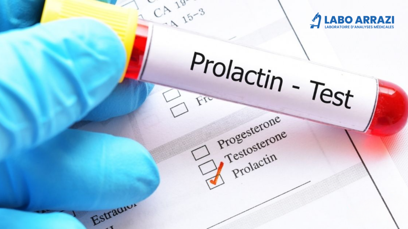 dosage prolactine